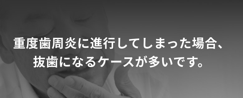 重度歯周炎に進行してしまった場合、抜歯になるケースが多いです。