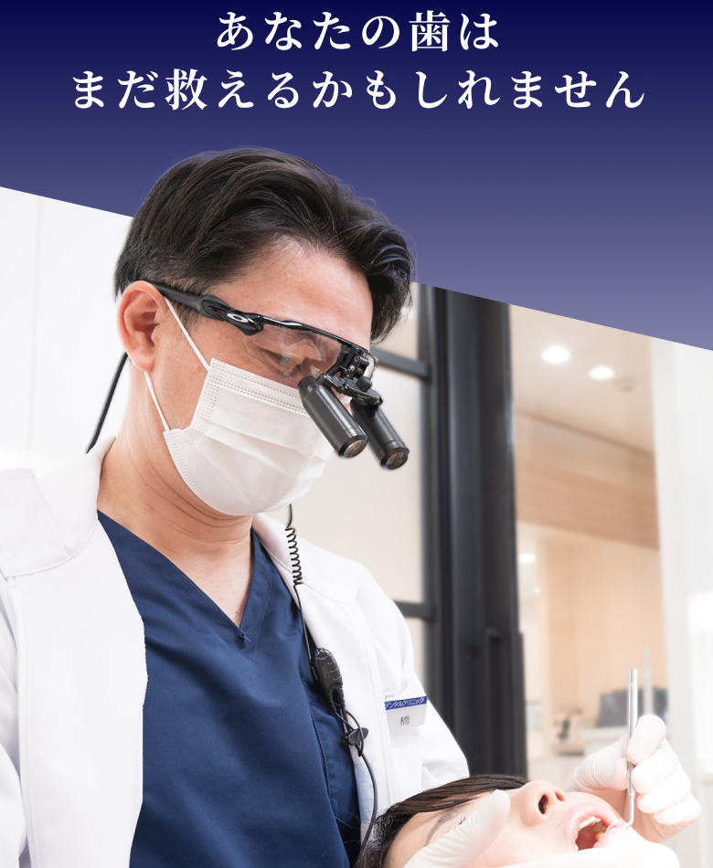 あなたの歯はまだ救えるかもしれません